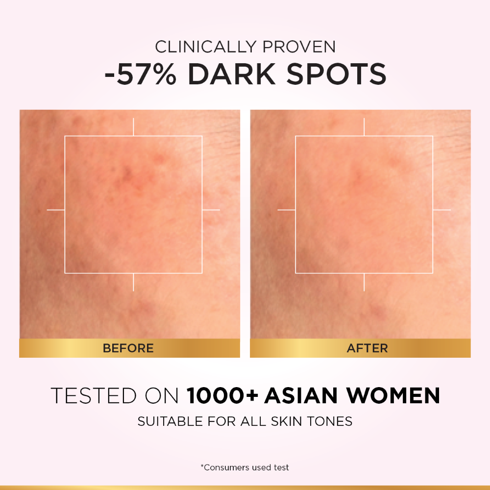 L'Oreal Paris Glycolic Bright Instant Glowing Serum, Reduces 57% Dark Spots, 15ml - Anti-Dark, Spot Brightening Face Serum - Image 4