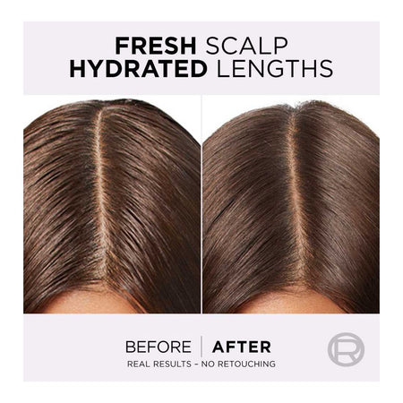 L'Oreal Paris Elvive Hyaluron Pure 72H Purifying Shampoo, Salicylic & Hyaluronic Acid, For Moisturize Hair, 175ml - Image 3