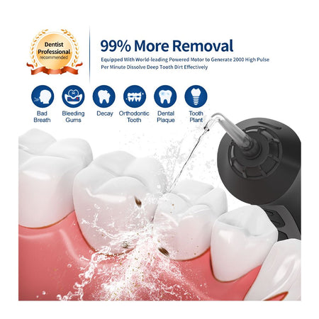 Seago Smart Water Rechargeable Dental Flosser/Irrigator Cordless USB, 3 Cleaning Modes, 5 Jet Tips, IPX7 Waterproof, Travel Bag, Black, SG-833 - Image 9