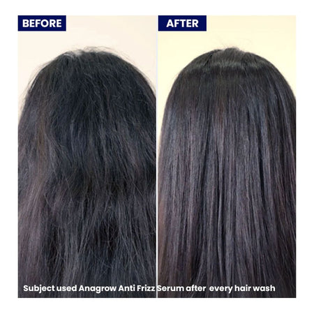 Anagrow Anti-Frizz Hair Serum, Vitamin E, For All Types Of Hair, 50ml - Image 3