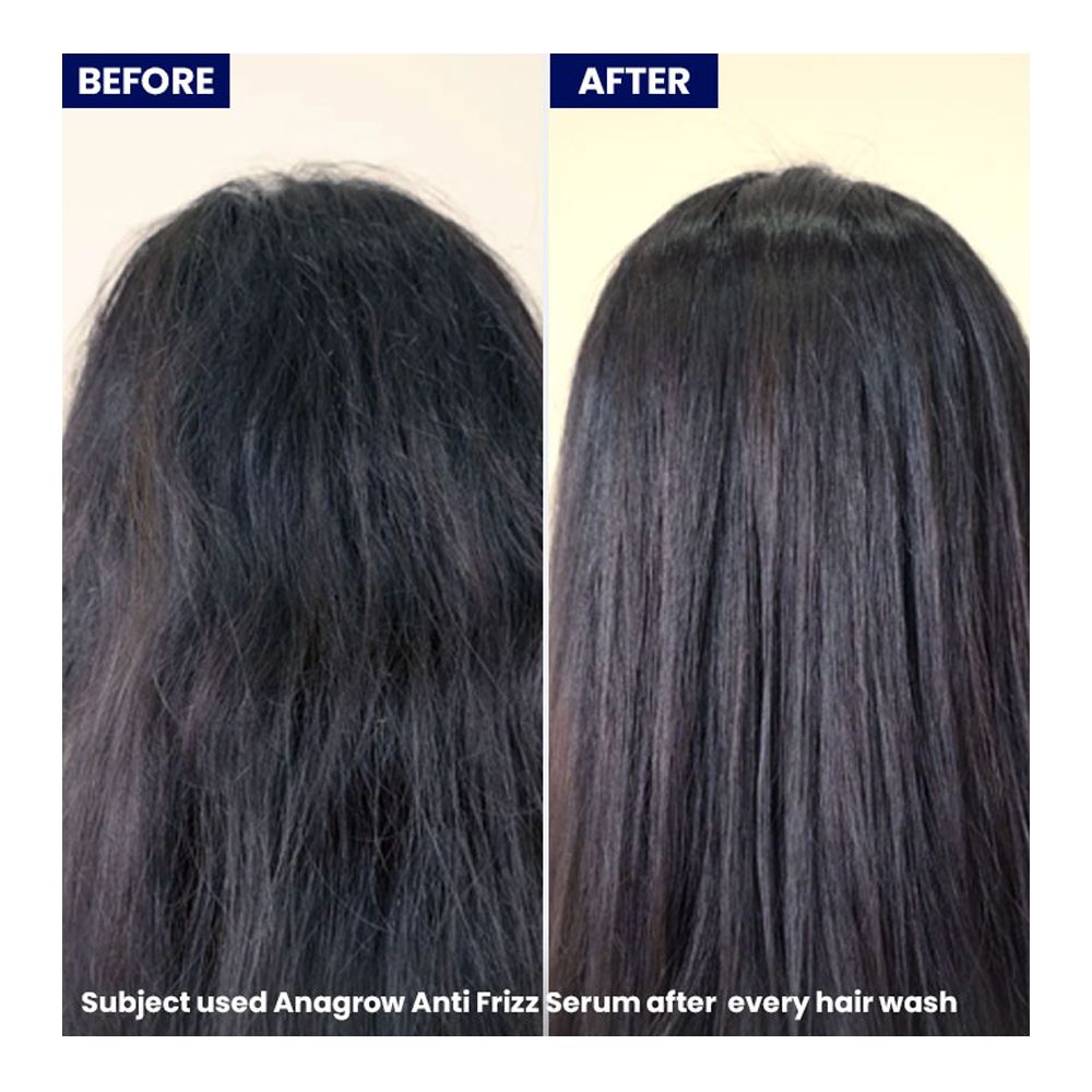 Anagrow Anti-Frizz Hair Serum, Vitamin E, For All Types Of Hair, 50ml - Image 3