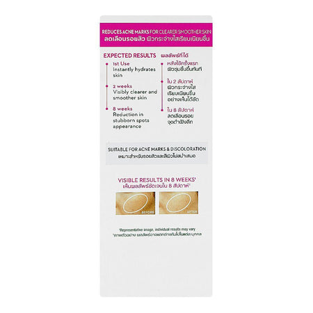 Olay Luminous Niacinamide AHA Super Serum, Lactic Acid, For Acne Marks, 30ml - Image 2