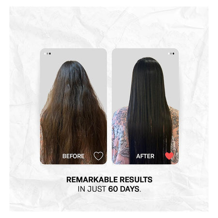 Treatments Moisturising Hair Shampoo, Vitamin A & C, Salicylic Acid, For Dry Hair, 250ml - Image 4