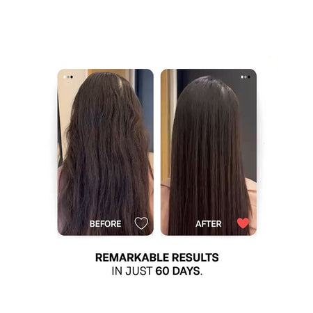 Treatments Caffeine Hair Shampoo, Niacinamide, Biotin, For All Types Of Hair, 250ml - Image 4