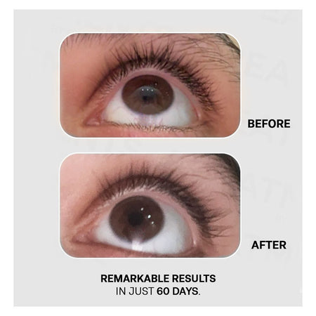 Treatments Medicated Lash Length Advanced Solution Eyelash Growth Serum, Rosemary Extract - Image 4