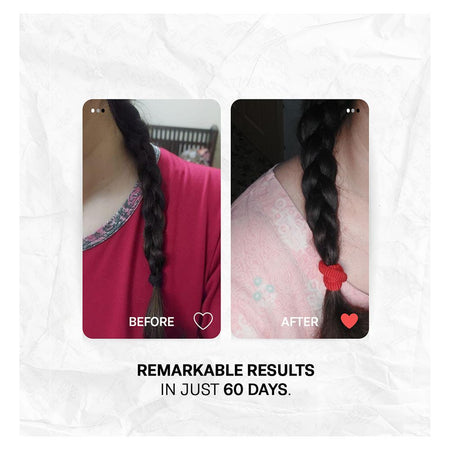 Treatments Hair Loss Advanced Solution Hair Volumizing Treatment, Rosemary Extract, Biotin, For Hair Loss, 30ml - Image 4