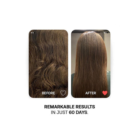 Treatments Rice Water Hair Thickening Treatment, Multivitamins, Minerals, For Hair Fall, 150ml - Image 4