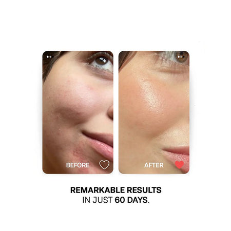 Treatments Radiance Boosting Facial Oil, Vegan, Vitamins A, C & E, For Radiance Skin, 30ml - Image 4
