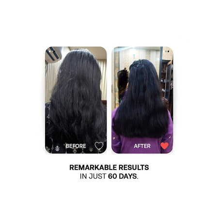 Treatments Gloss & Glow Hair Serum, Dimethiconol & Dimethicone, For Dry & Frizzy Hair, 50ml - Image 4