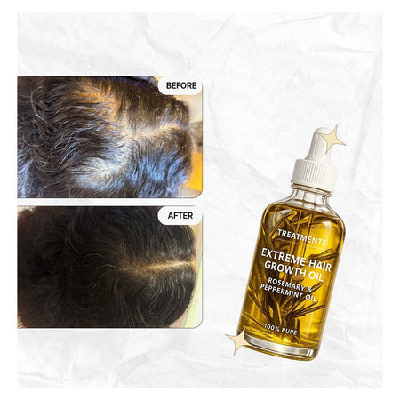 Treatments Extreme Hair Growth Oil Rosemary & Pepperment Oil, For Hair Growth, 100ml - Image 4