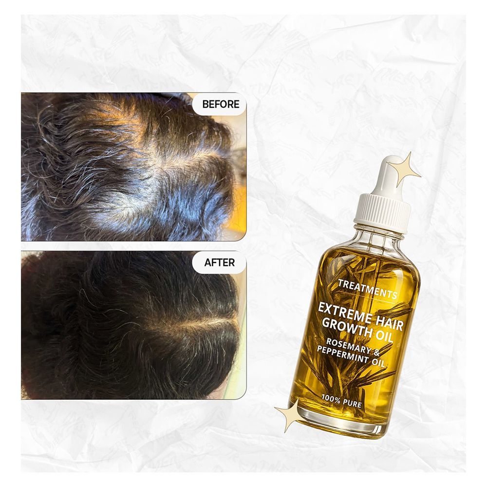 Treatments Extreme Hair Growth Oil Rosemary & Pepperment Oil, For Hair Growth, 100ml - Image 4