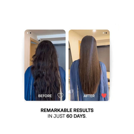 Treatments 10 Herbs Infused Hair Oil, Shikakai, Aloe Vera, For Hair Loss, 100ml - Image 4