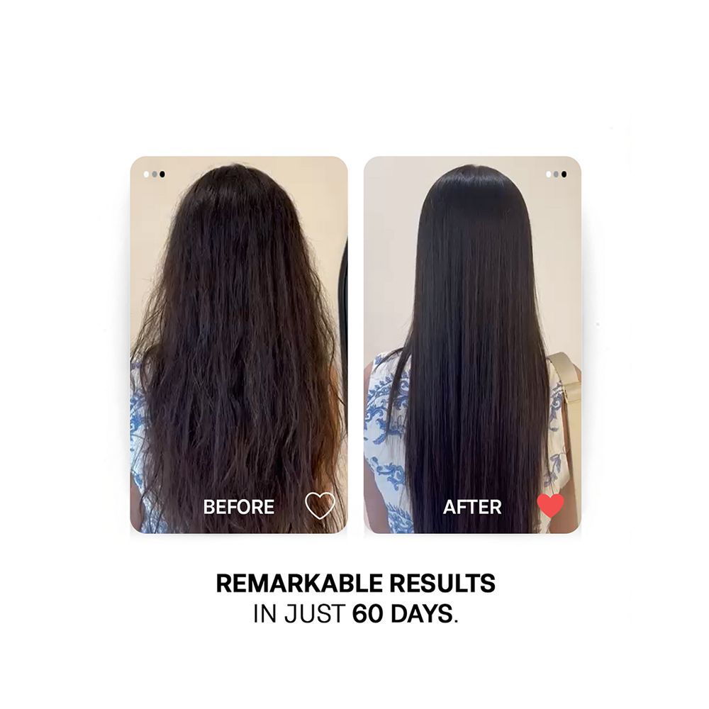 Treatments Keratin Dry Damaged Hair Conditioner, Citric Acid, Glycerin, For Damaged & Frizzy Hair, 200ml - Image 4