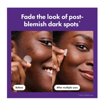 Hero Cosmetics Micropoint Mighty Patch, Vitamin C, Niacinamide, For Dark Spot, 8-Pack - Image 3