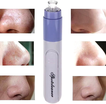Cell Operated Pore Cleaner - image 2