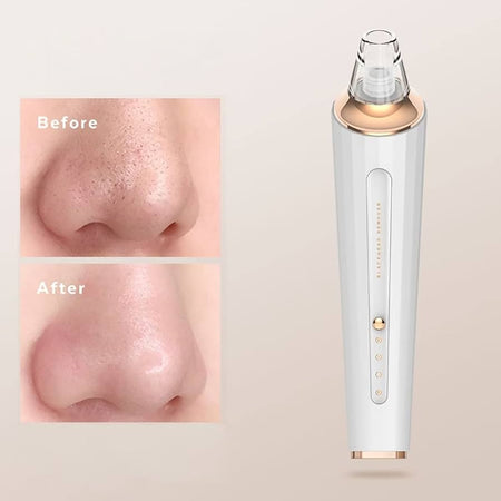 rechargeable facial pore cleaner image 6