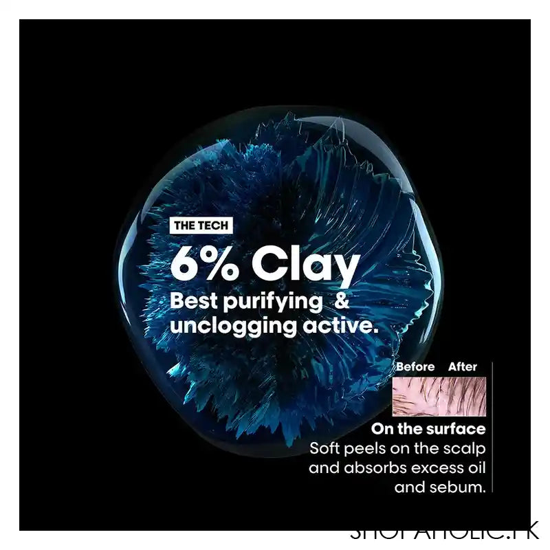 L'Oreal Professionnel Serie Expert Scalp Advanced AHA 3% Anti-Gras Oiliness, 300ml - Image 5