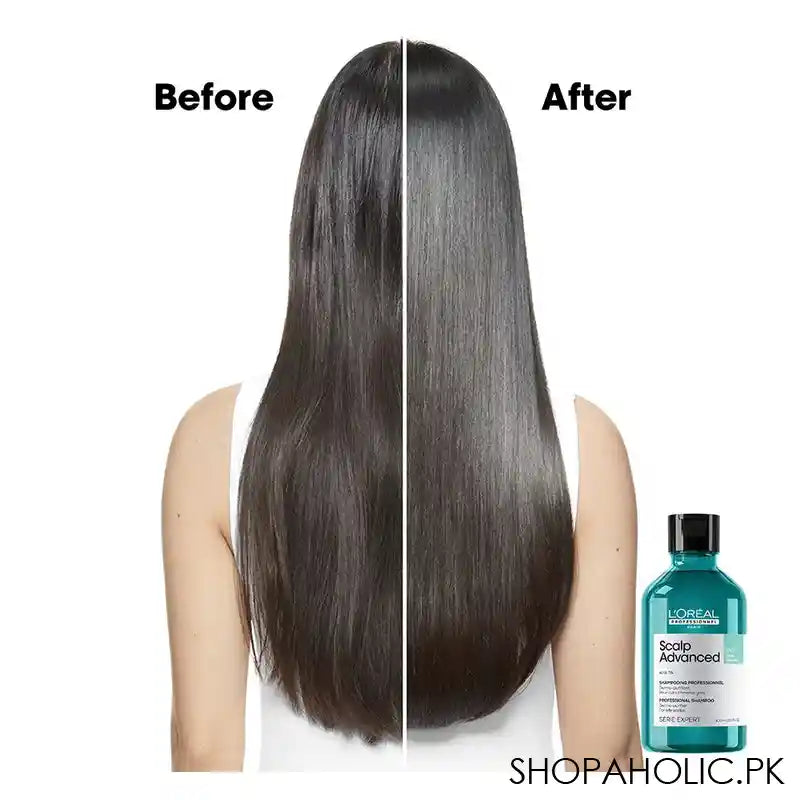 L'Oreal Professionnel Serie Expert Scalp Advanced AHA 3% Anti-Gras Oiliness, 300ml - Image 8