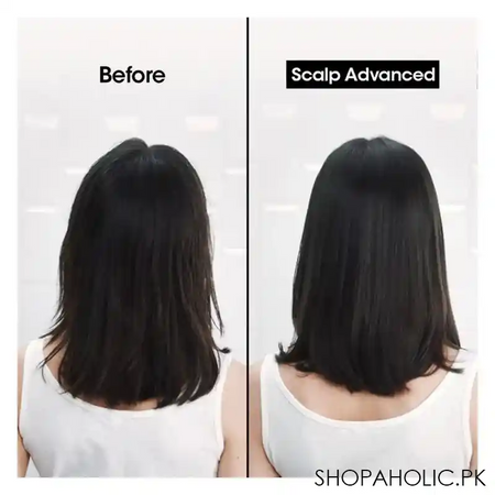 l'oreal professionnel serie expert scalp advanced anti pellicular dandruff professional shampoo, for scalps with dandruff, 300ml image6