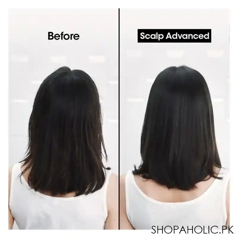 l'oreal professionnel serie expert scalp advanced anti pellicular dandruff professional shampoo, for scalps with dandruff, 300ml image6