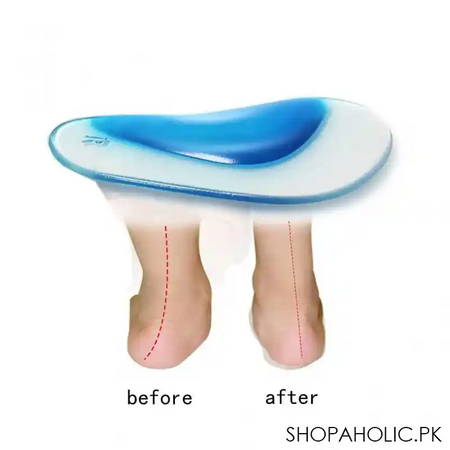 orthopedic arch support insole image3