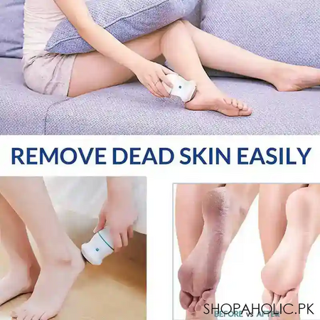 rechargeable find back callus remover with built in vacuum foot grinder machine hard crack cleaning image2