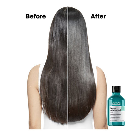 L'Oreal Professionnel Serie Expert Scalp Advanced Shampoo 300 ML - For Oily Scalp With AHA Formula - Image 3