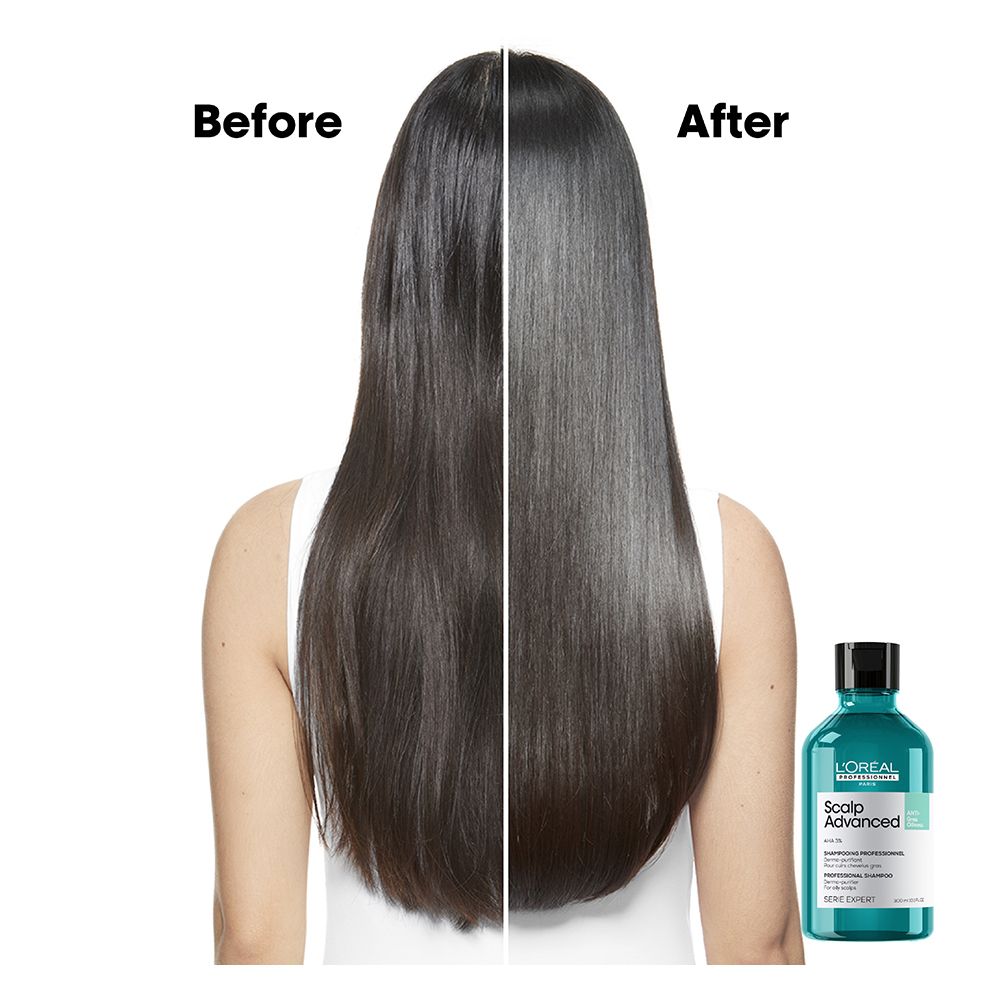 L'Oreal Professionnel Serie Expert Scalp Advanced Shampoo 300 ML - For Oily Scalp With AHA Formula - Image 3