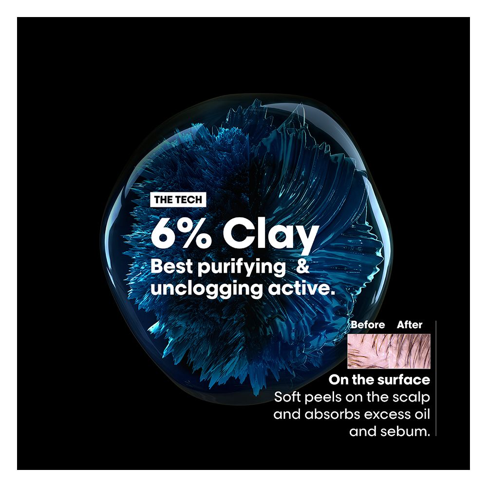 L'Oreal Professionnel Serie Expert Scalp Advanced Shampoo 300 ML - For Oily Scalp With AHA Formula - Image 5