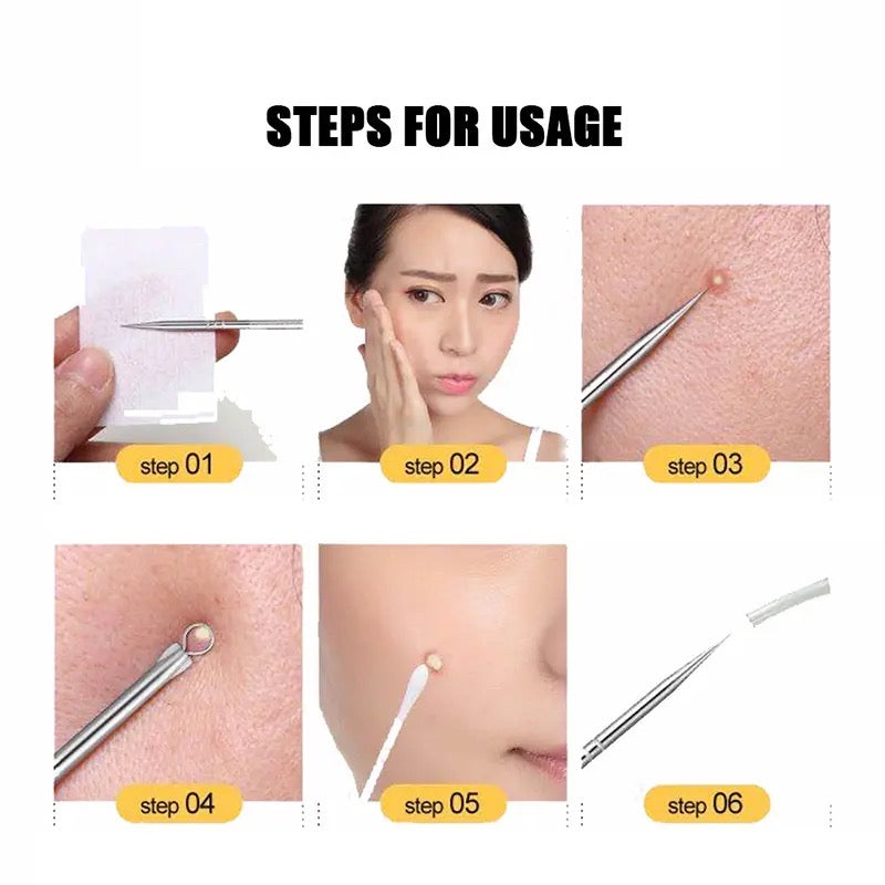 4 In 1 Multifunctional Acne Needles